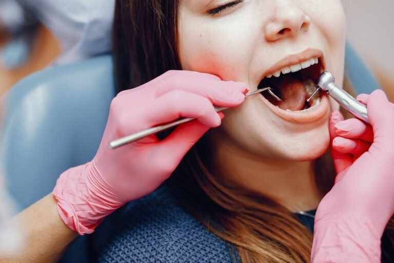 dental fillings
